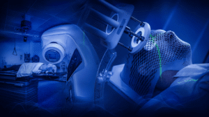 RADIOTERAPIA